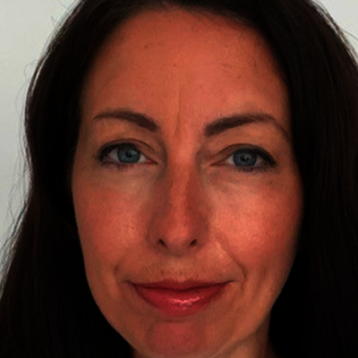 Hilary-Burkitt